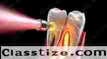 Advanced Root Canal Treatment in Chetla for Healthy Teeth