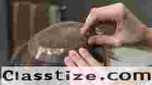 Hair Patch Service Near Me