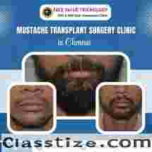 best Beard Transplant Clinic in Chennai