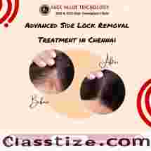 Advanced Side Lock Hair Removal Treatment in Chennai