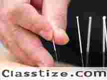 Acupuncture Therapy NYC