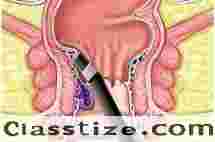 Experienced Fissure Surgeon in Kolkata | Dr. Purnendu Roy