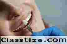 Advanced Dental Implant Clinic in Chetla for Perfect Smile  