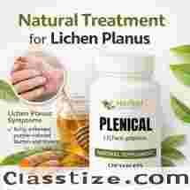 Herbal Remedies for Lichen Planus