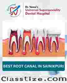 Top Reasons to Choose a Root Canal Specialist Over a General Dentist