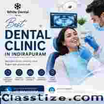 Best Dental Clinic in Indirapuram for Healthy and Beautiful Smiles