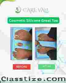 Best Artificial Leg  in Hyderabad | CareVale Prosthetics