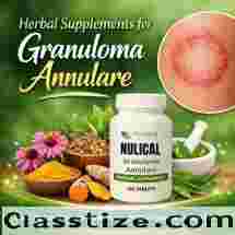 Natural Supplements for Granuloma Annulare Skin Lesions fast