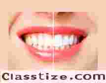 Achieve a Brighter Smile with Professional Teeth Whitening in Covina, CA