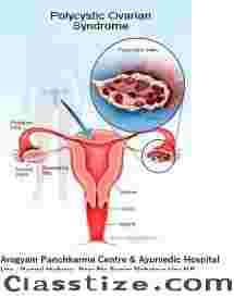 AROGYAM PURE HERBS KIT FOR PCOS/PCOD