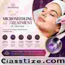 Best Microneedling RF Treatment in Indore - Aestheva 