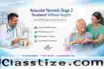 Avascular Necrosis Stage 2 Treatment Without Surgery – HipXpert