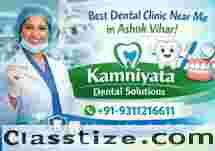 Best Dental Clinic Near Me in Ashok Vihar – Kamniyata Dental Solutions