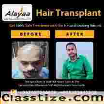 Hair Transplant in Chandigarh Expert Solutions for Natural Hair Restoration