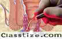 Expert Piles Surgeon in Kolkata – Dr. Purnendu Roy  