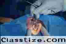 Advanced Cataract Surgery in Bardhaman for Clear Vision  