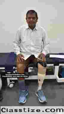 Free Artificial leg In Hyderabad | CareVale Prosthetics