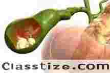 Trusted Choice for Gall Stone Surgery in Kolkata