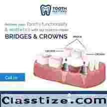  Tooth Matters Dental Clinic | Advanced Dental Crown Treatment 