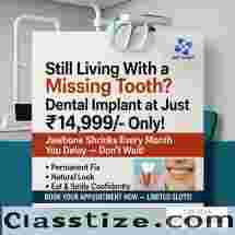 Dental Implant in Malviya Nagar Delhi at ₹14,999 | RHT Clinic (Limited Slots)