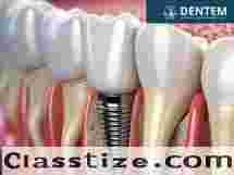 Dental Implant in Vasant Vihar | Dentem Center
