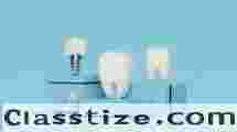 Affordable Dental Implant Clinic in Newtown