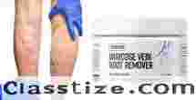 What makes VeinCare Root Remover different from other creams?