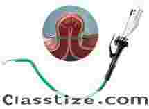 Leading Bariatric Endoscopy Treatment in Ludhiana – Dr. Nitin Behl