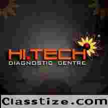Looking for the Best Labs in Kochi? Here’s Why Hi-Tech Diagnostic Centre Stands Out