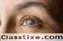 Effective Glaucoma Treatment in Bardhaman by Expert Eye Specialists