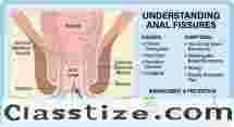 Advanced Piles Treatment in Dadar – Safe, Modern & Painless Care