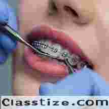 Best Dental Brace in Chetla for Smile Alignment   