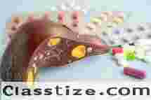 Advanced Cirrhosis Treatment Specialist Ahmedabad  