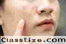 Best Acne Scar Treatment 2025 | Saluja Skin CLinic
