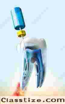 Save Your Natural Smile with Best Root Canal Treatment in Chetla
