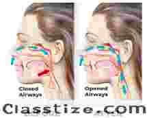 Snorestop Price : Cost, Value, and Buying Options Explained