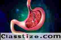 Advanced Endoscopy by Best Endoscopist Ludhiana   