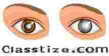 Need Glaucoma Treatment in Delhi? Book Your Eye Consultation Today