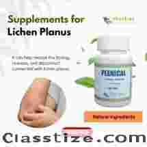 Herbal Supplement for Lichen Planus