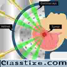 Affordable Cost Gamma Knife Radiosurgery in India