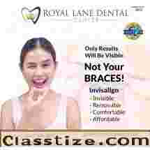 Clear Aligners in Dallas
