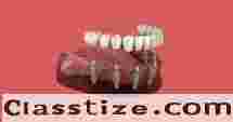 Trusted Dental Implant Solutions in Chetla