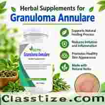 Best Supplements for Granuloma Annulare