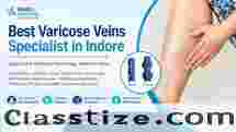 Best Varicose veins specialist in Indore