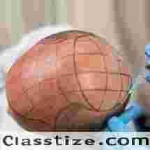 Hair Specialist Doctor in Hanamkonda
