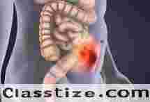 Advanced Hernia Care from a Skilled Surgeon in Dum Dum Park