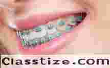 Best Dental Brace in Chetla for Perfect Teeth Alignment