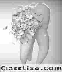 Discover expert dental care in Glenside, PA with our trusted dentist office.