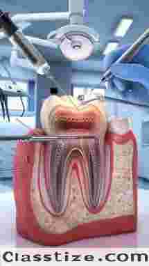 Restore Your Smile with Expert Root Canal Treatment in Chetla