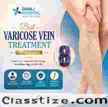 Best Varicose Vein Treatment in Indore - Sahaj Hospital